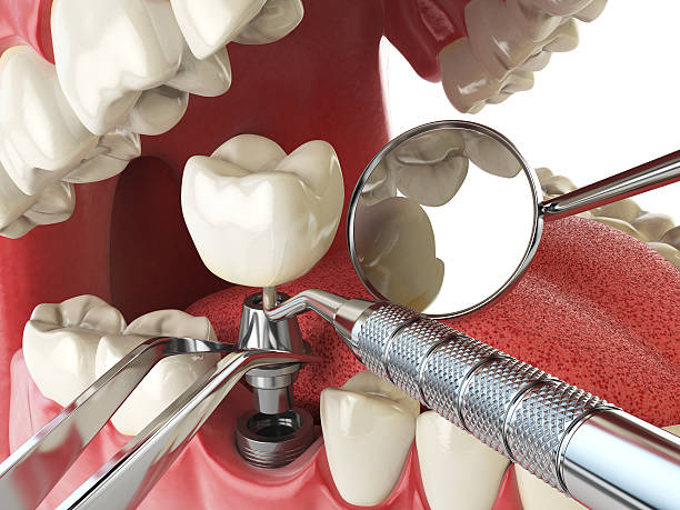 Best Emergency Treatment for Toothache in Goshen, CA