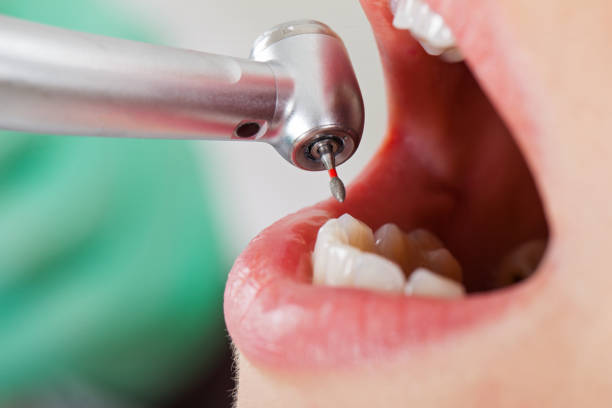 Best Weekend Emergency Dentist in Goshen, CA